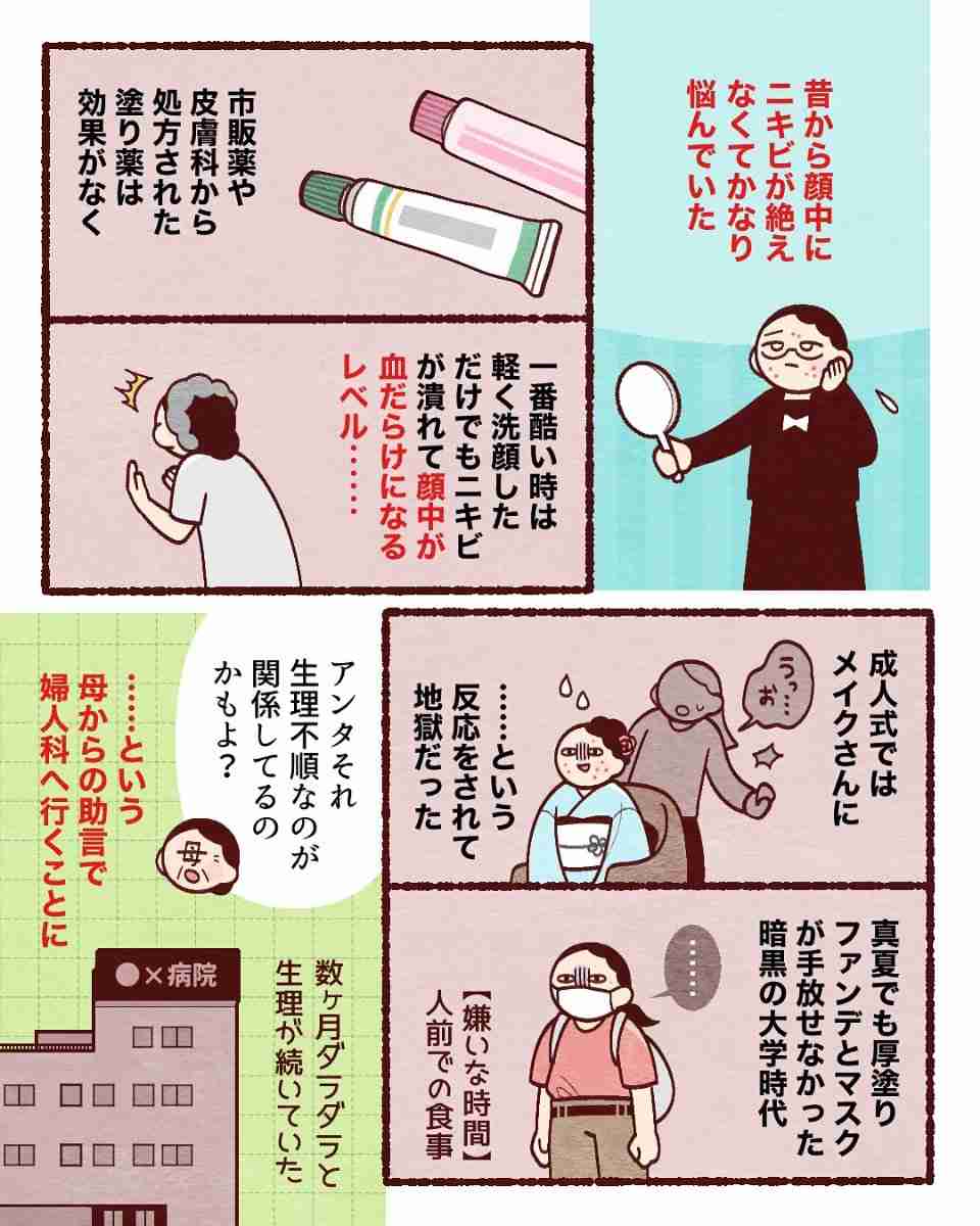 【漫画】「食事も外出も苦痛…」　顔中のニキビに長年苦しんだ女性　毎日の枕カバー交換も無意味だった「意外な原因」