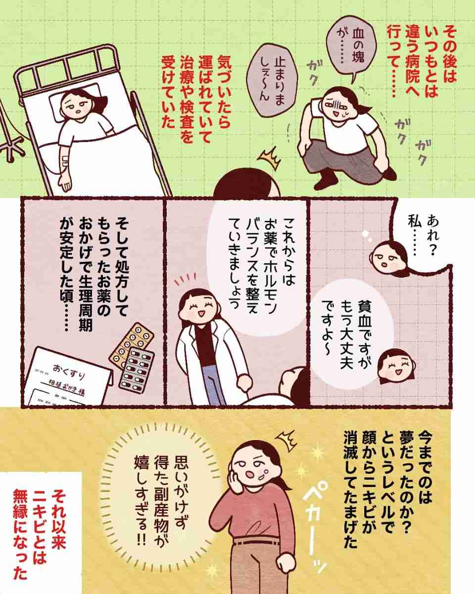 【漫画】「食事も外出も苦痛…」　顔中のニキビに長年苦しんだ女性　毎日の枕カバー交換も無意味だった「意外な原因」