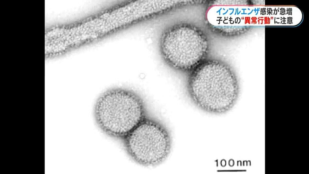 インフルエンザ「子どもの異常行動」起きやすいのはいつ？原因は？医師に聞く注意点…インフルエンザの感染急増 | 鹿児島のニュース｜MBC NEWS｜南日本放送 (1ページ)