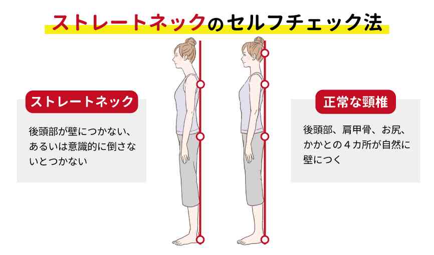 20歳以上の40％とも…現代病「ストレートネック」　スマホやパソコンの使い過ぎで首や頭に痛み…メカニズムや予防法を専門医が解説