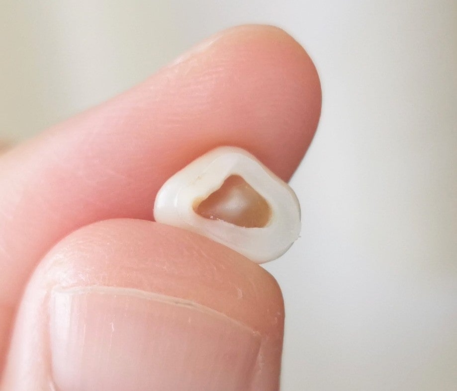 第一乳臼歯抜けた長女 | 娘2人となずな