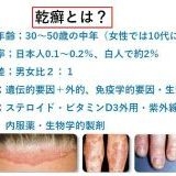 あくまで私の考えついたやり方なので誰しもに効果があるかは分かりませんが、あま... | ガールズちゃんねる - Girls Channel -