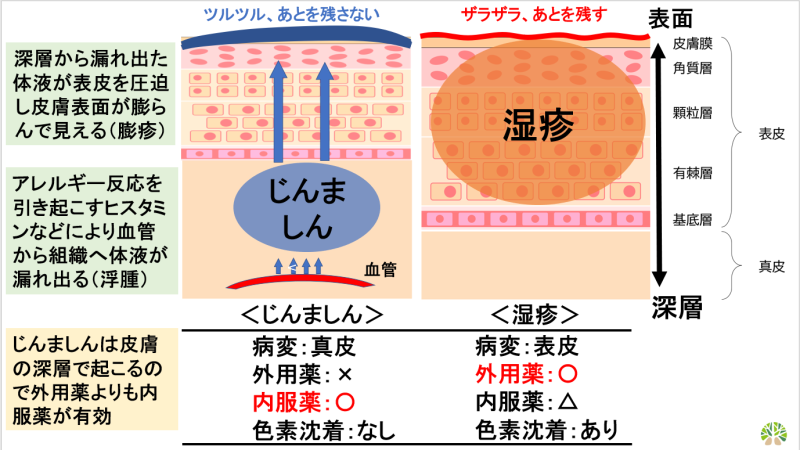 蕁麻疹で悩んでる人