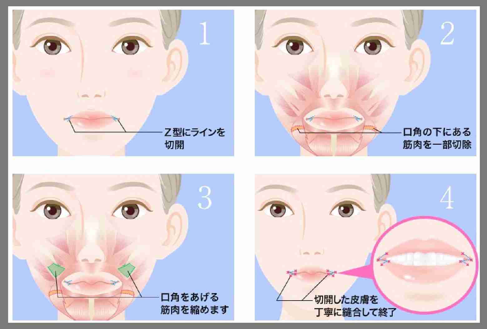 TPOは大事ですよね
