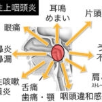 万年風邪は上咽頭炎を疑って。抗生剤の乱用に注意。抗生剤は ”風邪薬” ではありません。