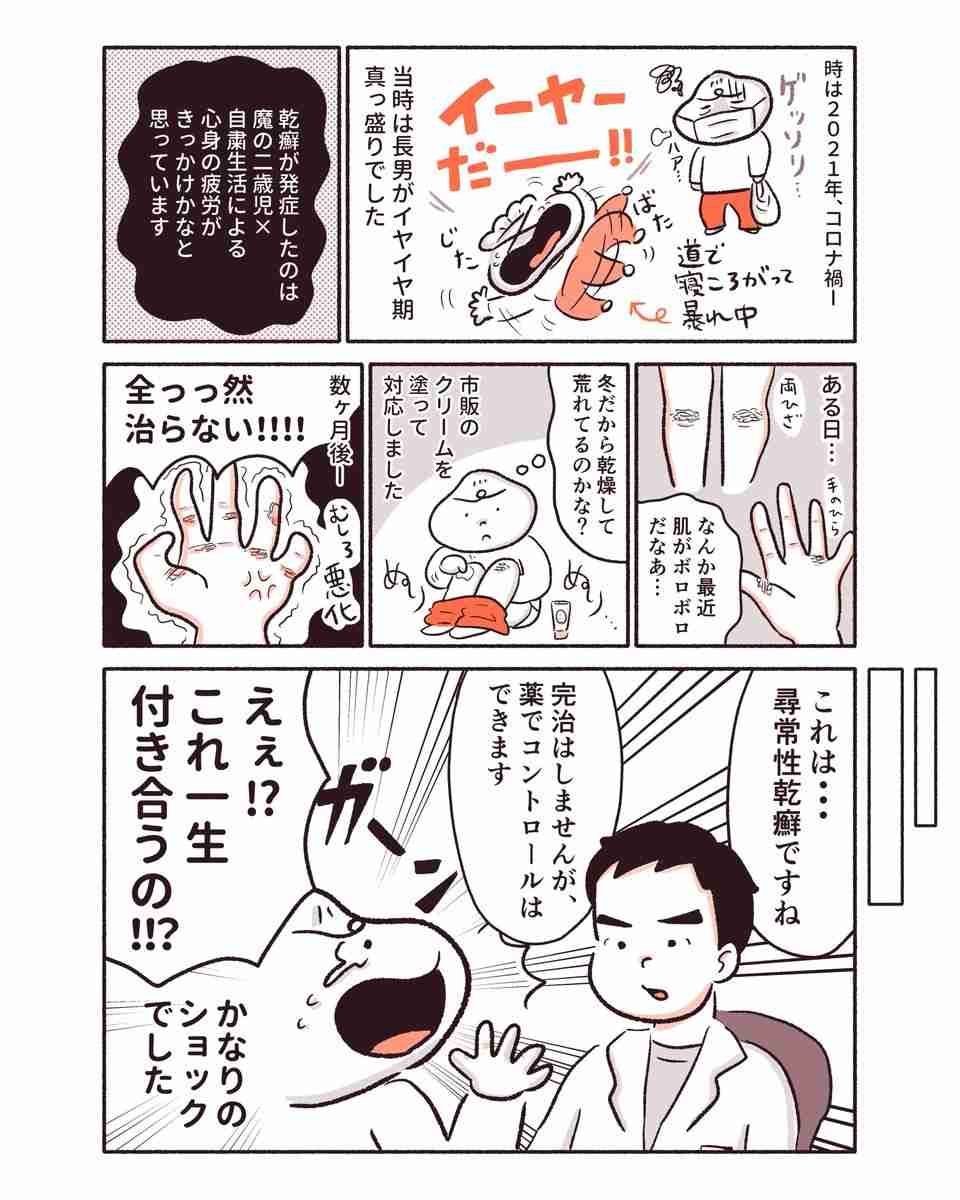 「私は黒い服が着られなくなった」 偏見を受けることも…皮膚の病気「乾癬」のリアル 女性が描いた実体験漫画に感謝の声