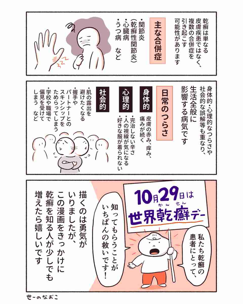 「私は黒い服が着られなくなった」 偏見を受けることも…皮膚の病気「乾癬」のリアル 女性が描いた実体験漫画に感謝の声
