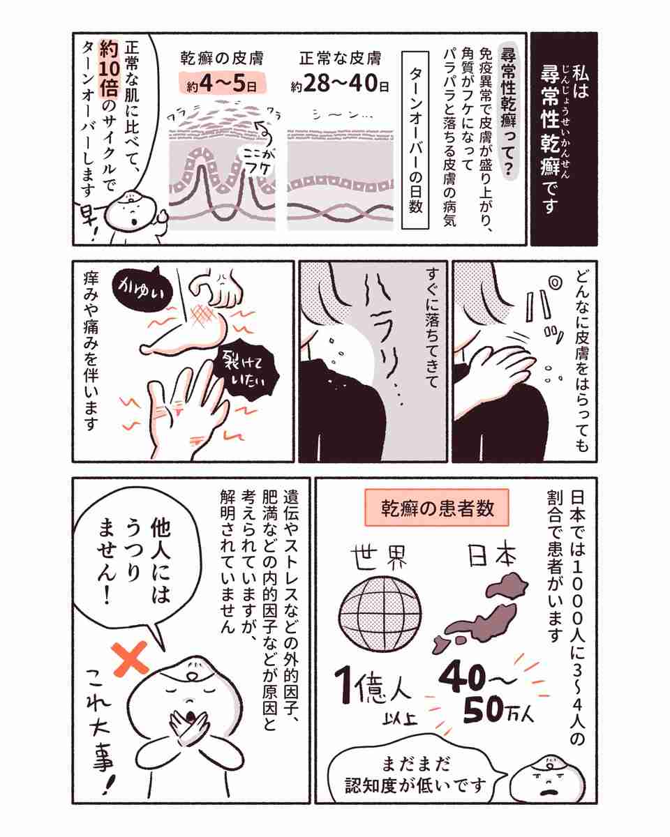 「私は黒い服が着られなくなった」 偏見を受けることも…皮膚の病気「乾癬」のリアル 女性が描いた実体験漫画に感謝の声