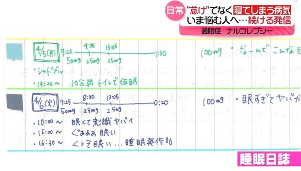 仕事中に居眠り…それ、病気かも？　過眠症“ナルコレプシー”の女性、YouTubeで発信　「やばい完全に私」共感の声『every.特集』