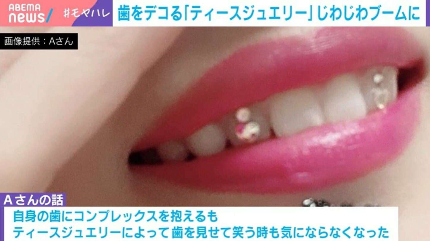 じわじわブームの「ティースジュエリー」とは?キラキラの裏に潜むリスクを歯科医師が注意喚起