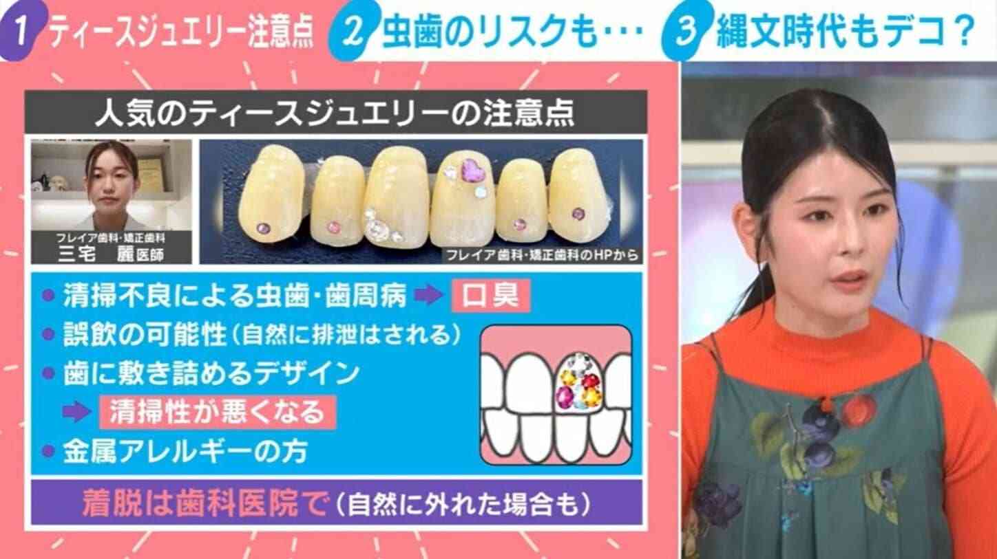 じわじわブームの「ティースジュエリー」とは?キラキラの裏に潜むリスクを歯科医師が注意喚起