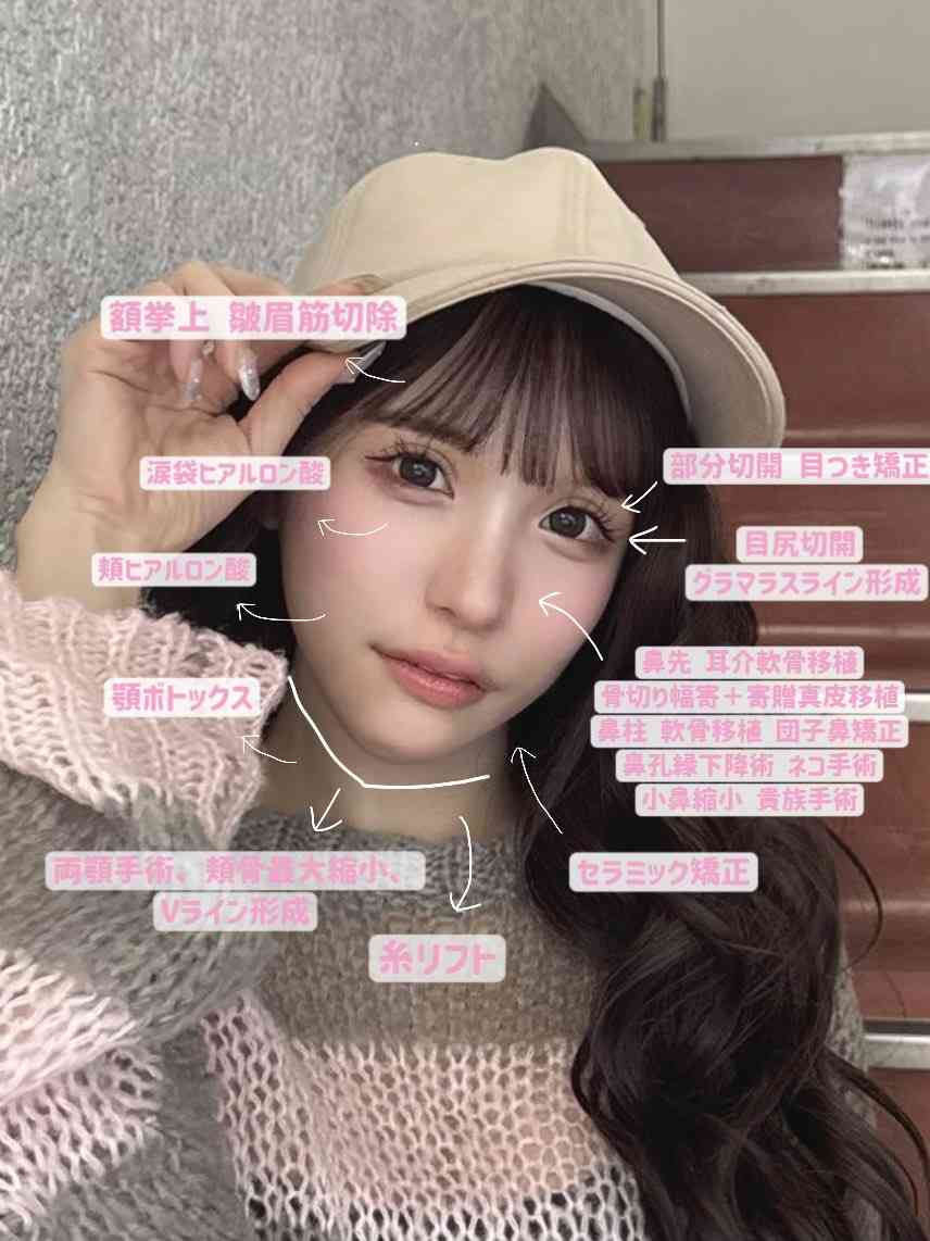 整形総額2600万円の平瀬あいり、“人生変わった”整形マップ公開 ネット驚き「めちゃくちゃ努力されたのですね」
