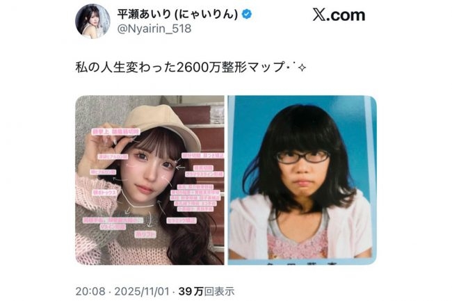 整形総額2600万円の平瀬あいり、“人生変わった”整形マップ公開 ネット驚き「めちゃくちゃ努力されたのですね」