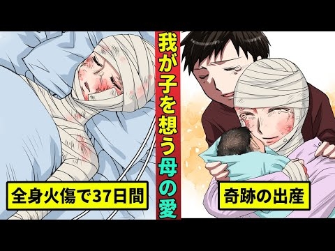 37日間激痛と闘った妊婦…お腹の子供のためにヤケドに耐え続けた母を漫画にした