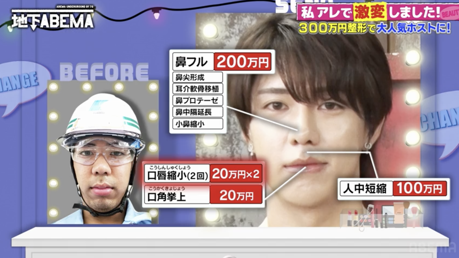 「売り掛け飛ばれて1年間給料0円」どん底ホストを変えた“330万円の整形”に絶賛の声「あんまやってない感じする」「センスある」