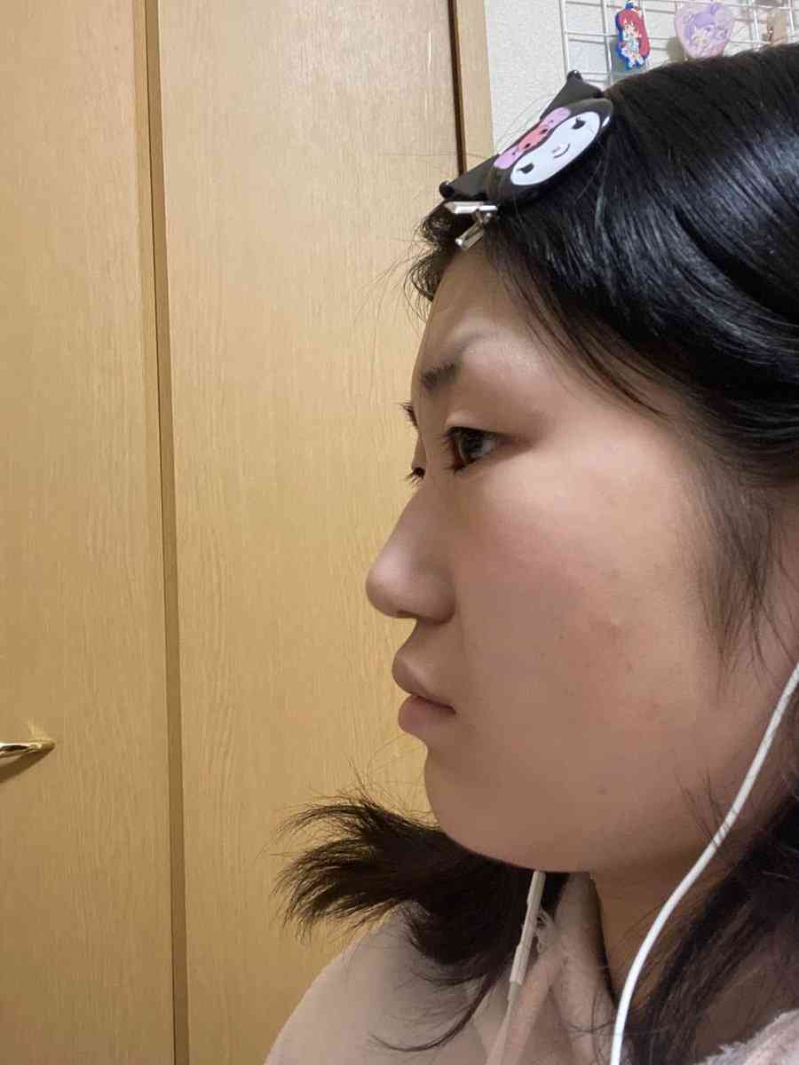 「同一人物ですか?」 現役アイドルの18歳→22歳ビフォーアフターにネット衝撃「すごい!」「うそやん」