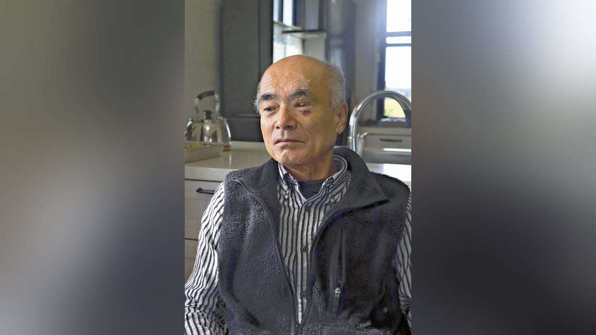 クマに顔引き裂かれ、神経・筋肉失い手術５回…後遺症に苦しむ男性「駆除しないと」「かわいそうとは思わないよ」　 : 読売新聞