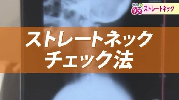 20歳以上の40％とも…現代病「ストレートネック」　スマホやパソコンの使い過ぎで首や頭に痛み…メカニズムや予防法を専門医が解説｜FNNプライムオンライン