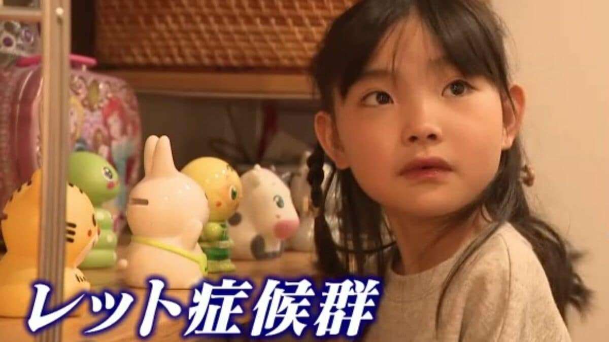 ｢2歳の頃はママ･パパと呼んでくれていたのに｣ 主に女の子に発症する難病“レット症候群” 今は会話も食事も難しく… 根本的治療法がない先天性の神経疾患 | TBS NEWS DIG