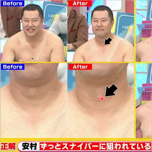 「テレビにゴミ付いてると思ったら」生放送出演者にレーザー照射、企画に視聴者衝撃