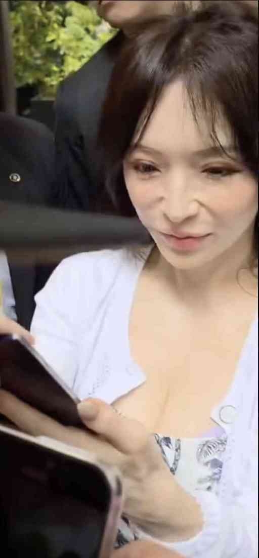 肥満治療薬「GLP-1」が脱毛の原因に？　専門家が真偽を解説