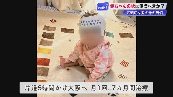 「枕なし」を信じたのに…赤ちゃんの頭がぺっちゃんこ、枕は必要か?国や医師の見解が真っ二つ