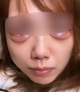 【美容医療】女性は「豊胸」が急浮上、では男性の1位は？ 「ヒゲ脱毛」かと思いきや…男女共通でトップを独占した“顔のパーツ”