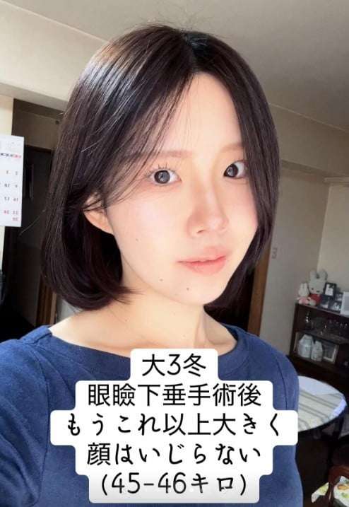 二重整形を3回失敗、下剤の過剰摂取も…外見すべてがコンプレックスだった女性、垢抜けるまでの10年間「成長するために過去があった」