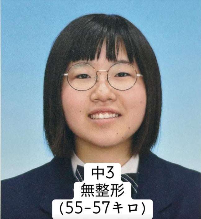 二重整形を3回失敗、下剤の過剰摂取も…外見すべてがコンプレックスだった女性、垢抜けるまでの10年間「成長するために過去があった」