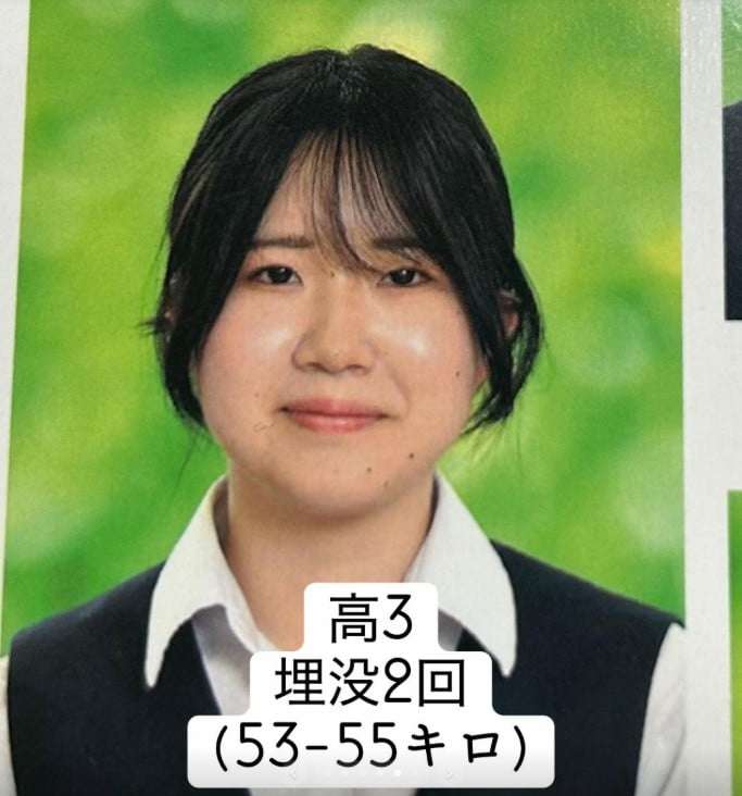 二重整形を3回失敗、下剤の過剰摂取も…外見すべてがコンプレックスだった女性、垢抜けるまでの10年間「成長するために過去があった」