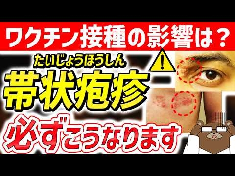 【危険】知らないと後悔する..急増している「帯状疱疹」の超意外な危険サイン。ワクチン接種の影響は？なぜ増加しているのか。恐ろしい「帯状疱疹の後遺症」とは。予防法はあるのか。医師が完全解説。