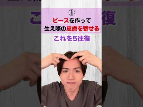 ボトックス不要!!おでこのシワが1回で解消する前頭筋剥がし