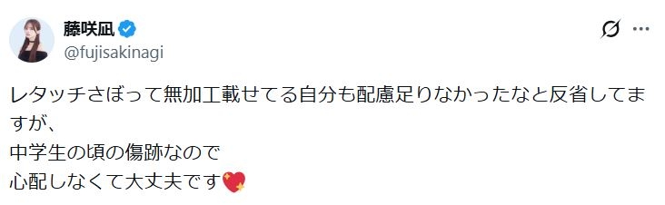 再婚発表の藤咲凪 腕の“リスカ傷”指摘受け説明「中学生の頃の…心配しなくて大丈夫です」