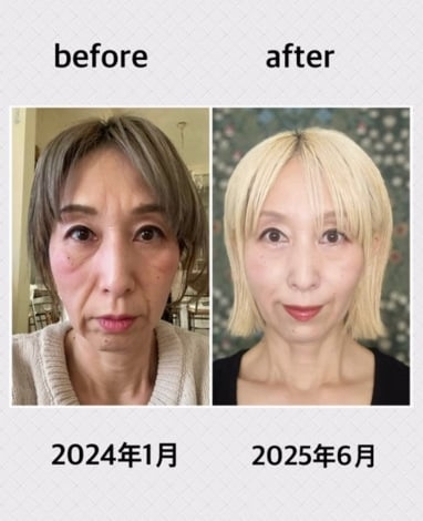 鏡の中の老け込んだ自分に「泣きたくなる毎日でした」50代女性の決意、美容医療一切なしで若返った1年半の軌跡