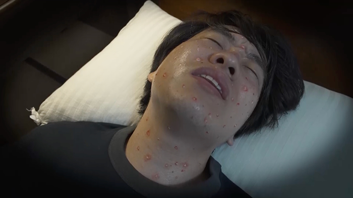 しいたけで全身に激しいかゆみ 理由は調理法にあった？｜ザ！世界仰天ニュース｜日本テレビ