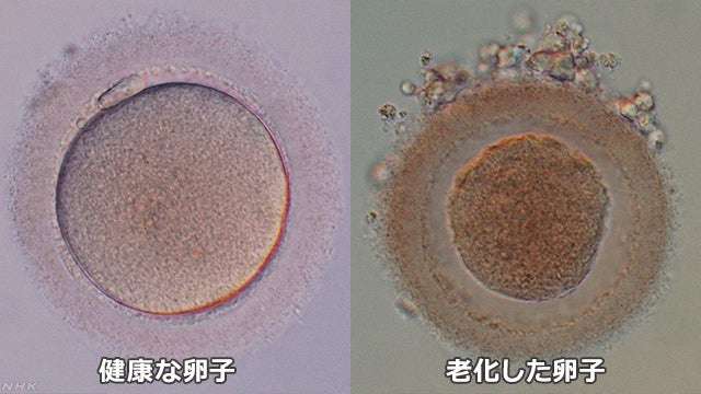 【歳の差恋愛】年齢差の感じ方について