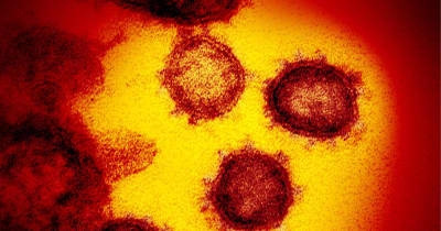 新型コロナ死者15.8万人　高齢中心に高水準、初確認6年 | NEWSjp