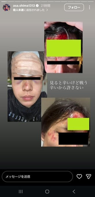 熊本市でも中学生が暴行受ける様子が…SNSで拡散 被害者の母親は警察に相談