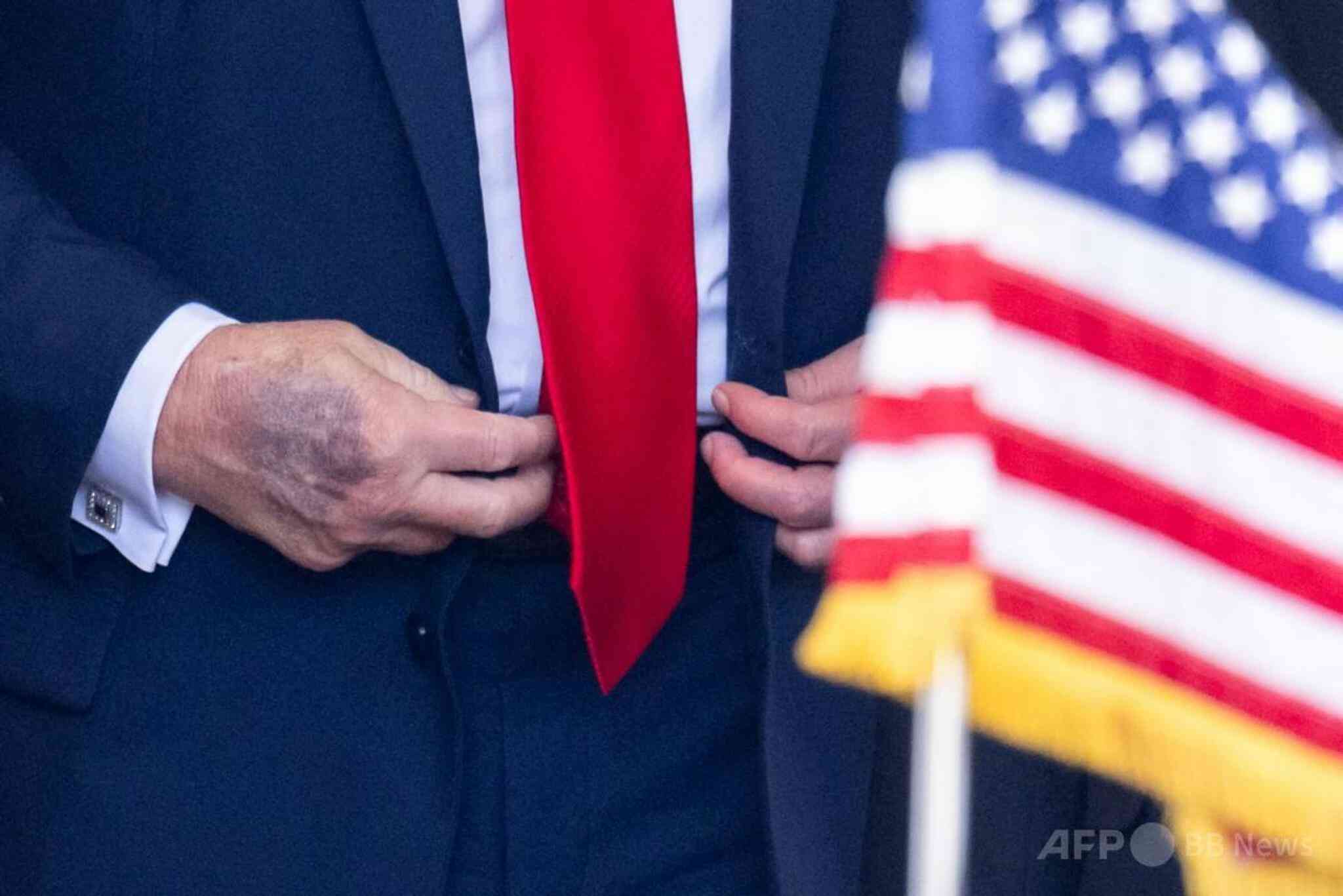 トランプ氏、公の場での居眠り否定 右手のあざはアスピリンのせい（ＡＦＰ＝時事） - Yahoo!ニュース