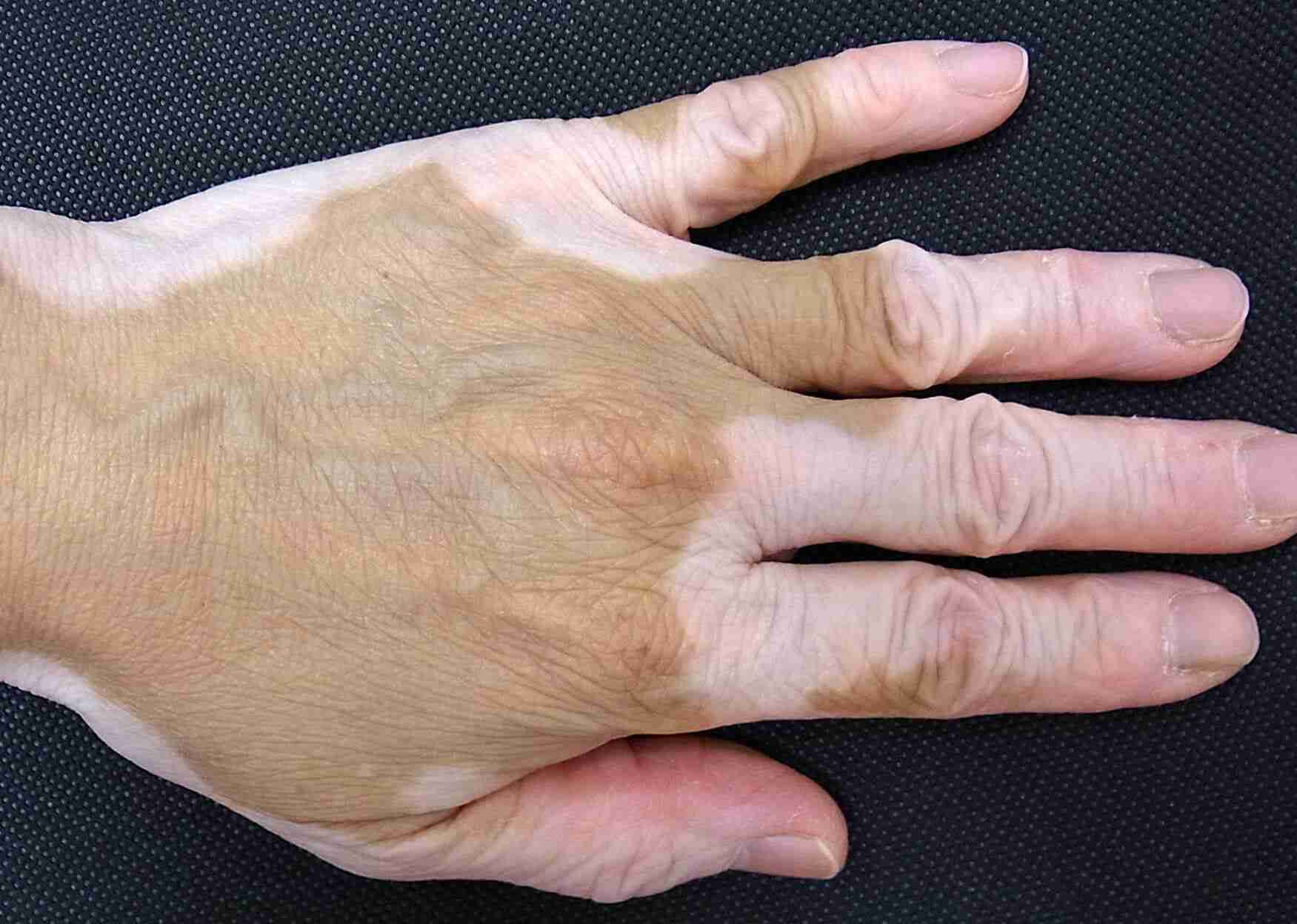 骨切り？鼻先尖鋭術？益若つばさが整形疑惑にぶっちゃけ「ギャルの時からあまりにも顔が違いすぎる」