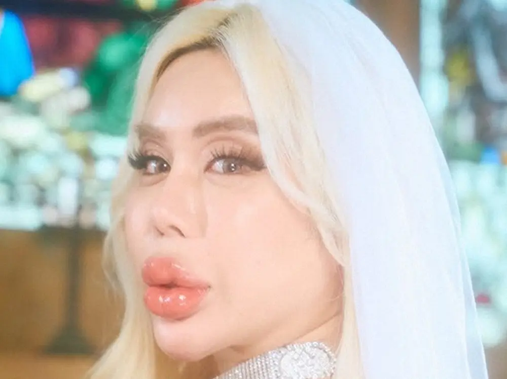 【記事全文】アレン様　衝撃の月額美容代「40～50万とかザラに。エステも16万くらい」若槻千夏「何すんの？」 - スポニチ Sponichi Annex 芸能