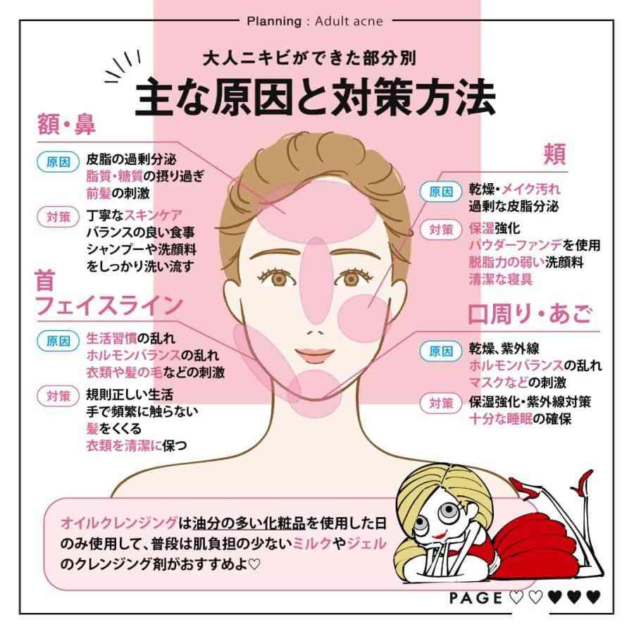 【助けて】おでこに大量のニキビ | ガールズちゃんねる - Girls Channel -