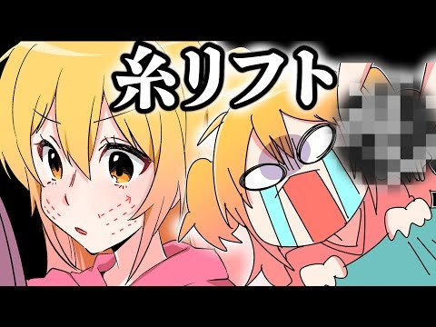 糸リフトをしに整形外科に行った話 【実話】