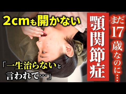 【悲劇】まだ高校生なのに「一生治らない」と宣告された娘。重度の顎関節症を癒着剥がし！