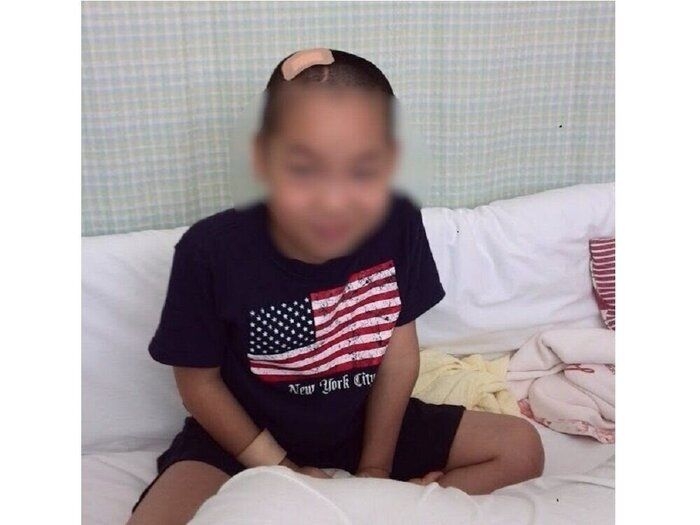 麻疹に感染した子どもに約10年後に発症…SSPEと診断された二男。麻疹の後遺症の脳炎と向き合う家族。「この世から麻疹がなくなってほしい」【体験談】 ｜たまひよ