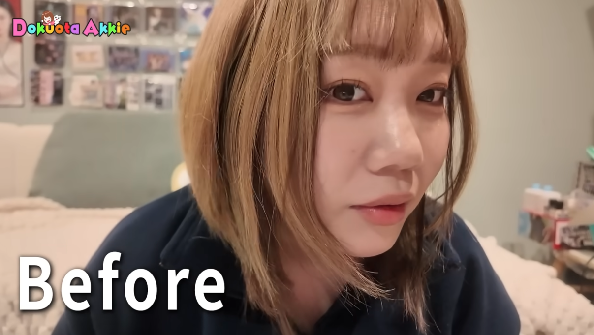 登録者70万人超の女性YouTuber、鼻の整形手術で「めっちゃ満足」 ファン反響「かわいい系から綺麗系に」