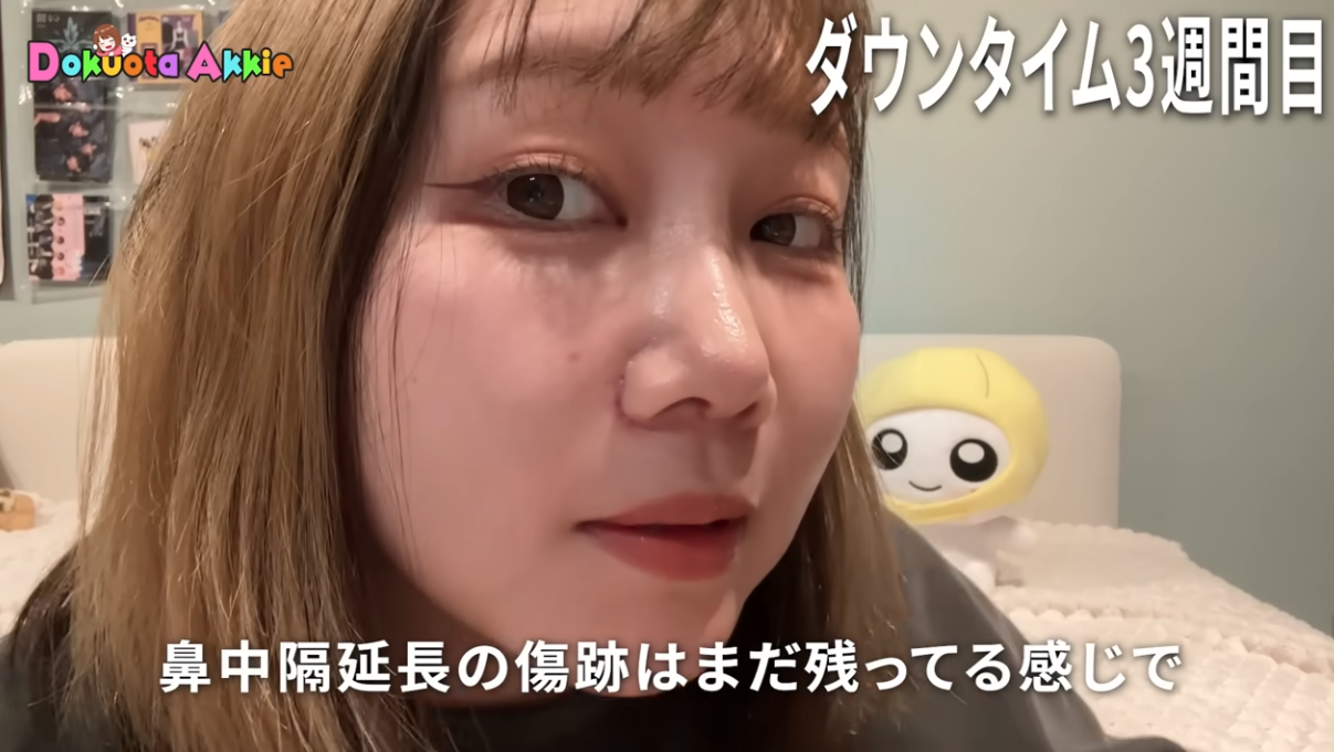 登録者70万人超の女性YouTuber、鼻の整形手術で「めっちゃ満足」 ファン反響「かわいい系から綺麗系に」