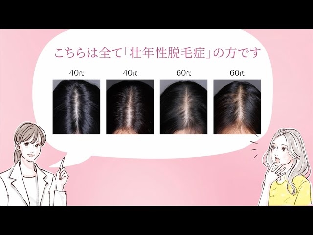 髪の毛の成長メカニズムは「押し出し」ではなく「引き上げ」だった。薄毛治療を変える可能性