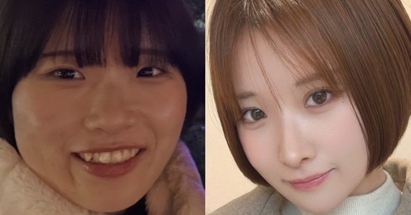 【整形美女】「自分を嫌いなまま生きるのがしんどかった」二重整形で“終われなかった”女性の変わりたい思い  | オリコンニュース（ORICON NEWS）
