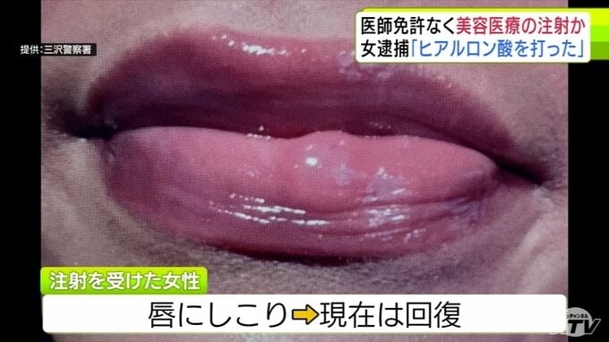 客の唇には
